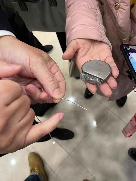 有望治疗难治性抑郁症 上海瑞金医院脑机接口及神经调控中心成立-肽度TIMEDOO
