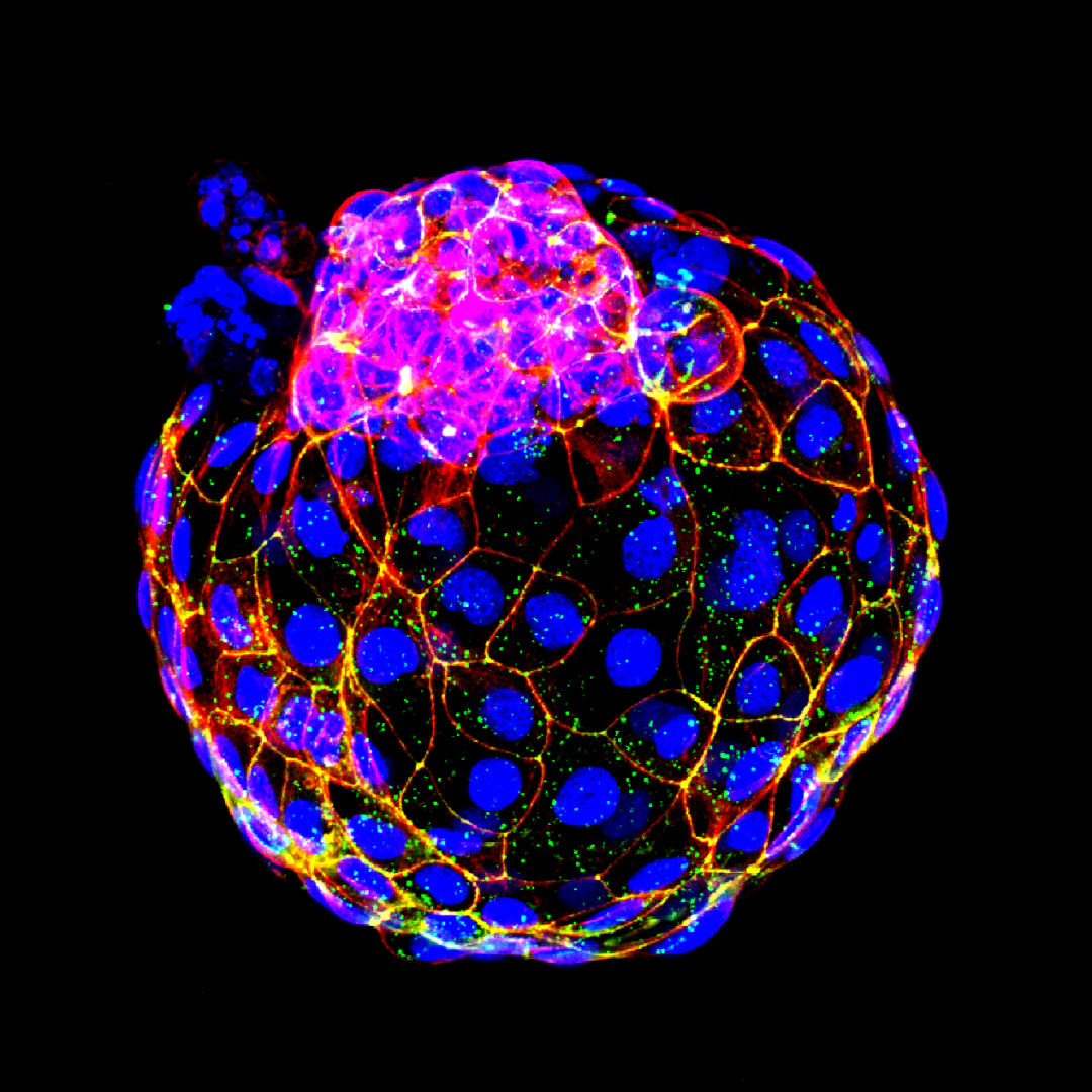 全球最完整人类胚胎模型诞生,中国科学家领衔构建,将给发育生物学带来变革性推动-肽度TIMEDOO