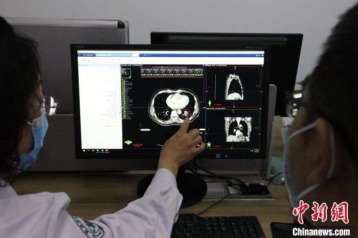 图为医生进一步锁定肿瘤位置。 魏建军 摄 探访中国首个碳离子癌症治疗中心:已达全球同等水平-肽度TIMEDOO
