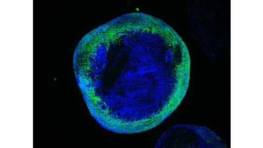 科学家创造首个莱氏症候群人类模型