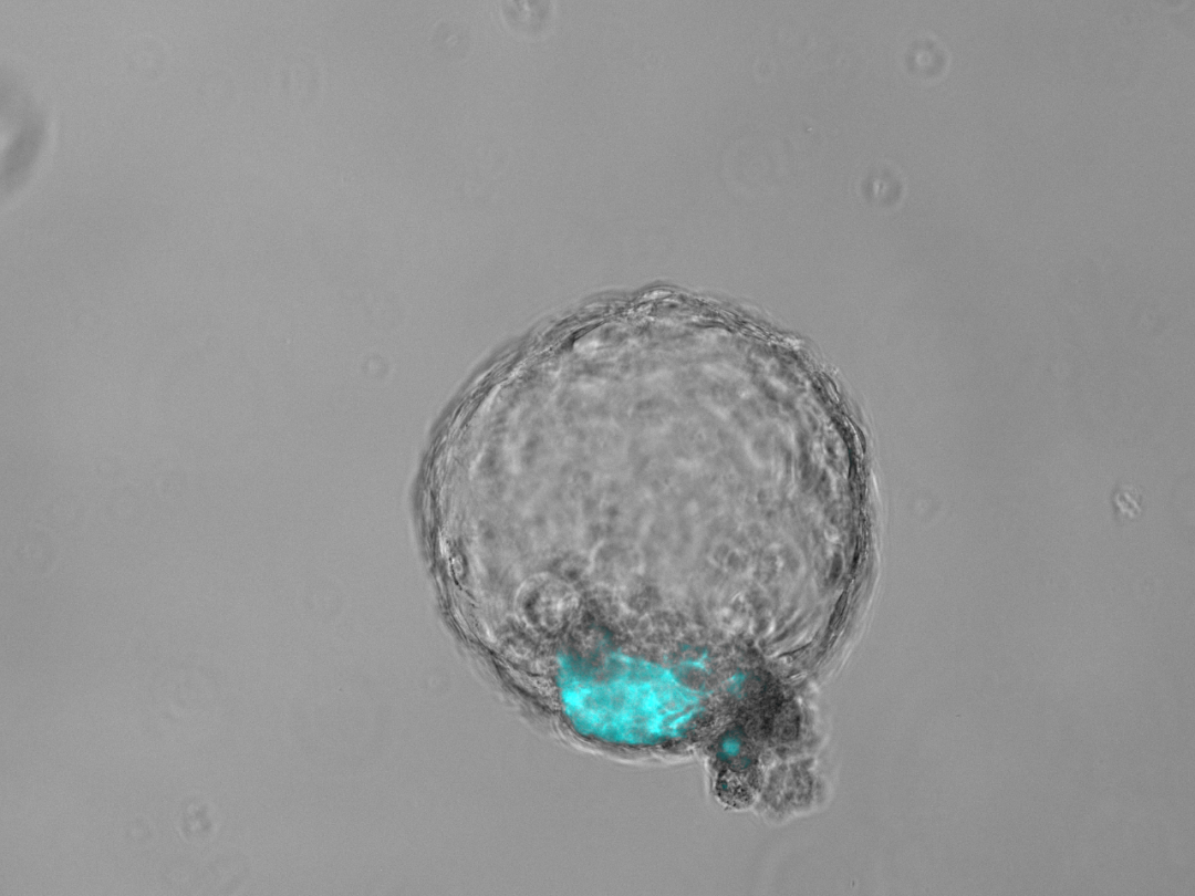 全球最完整人类胚胎模型诞生,中国科学家领衔构建,将给发育生物学带来变革性推动-肽度TIMEDOO
