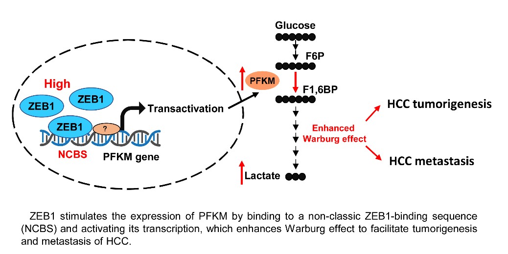 厦门大学李勤喜教授课题组揭示ZEB1增强Warburg Effect，促进肝细胞癌发生和转移的机制