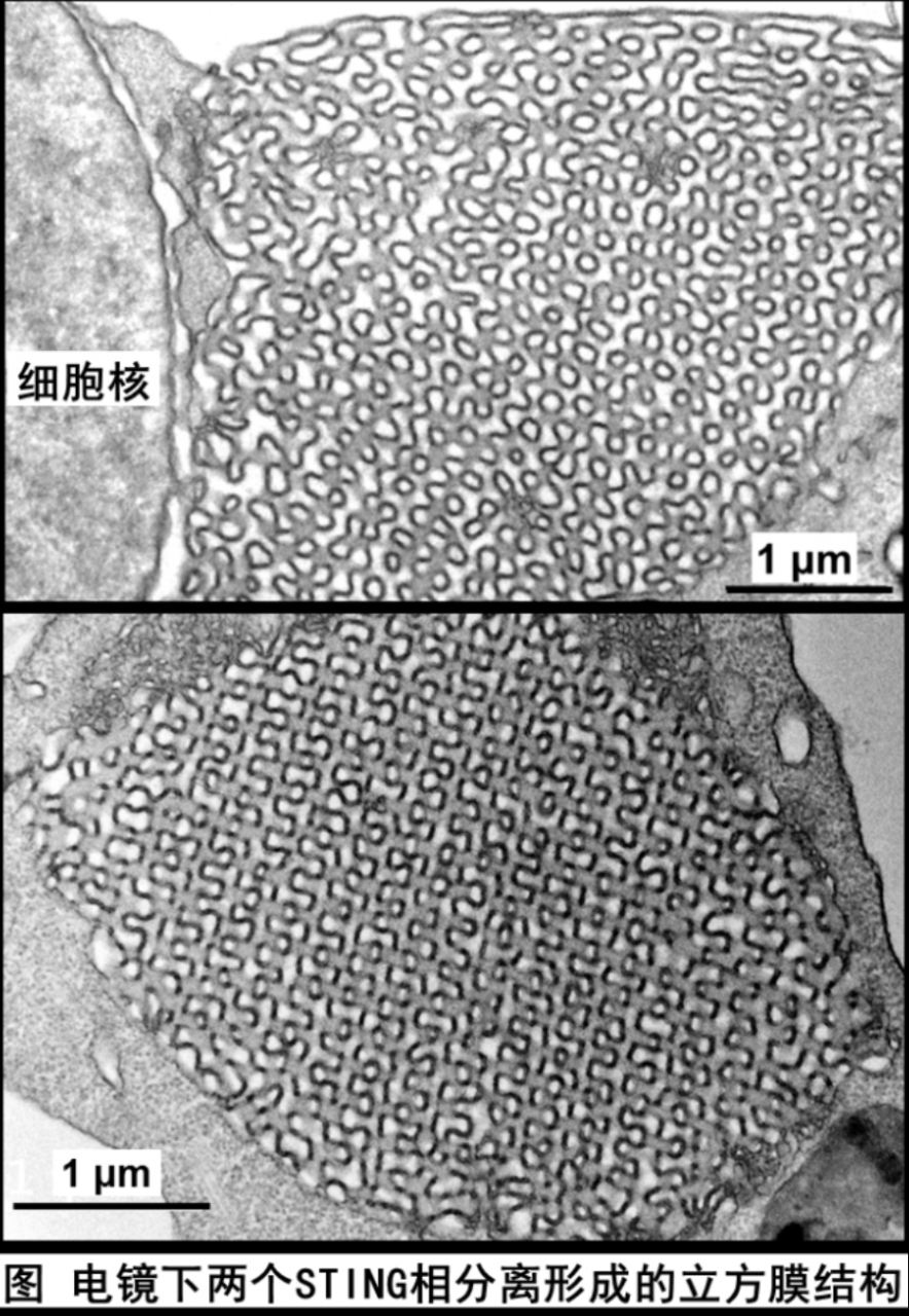 北京大学生命科学学院蒋争凡实验室发现STING蛋白相分离调节天然免疫