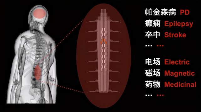 清华学者让AI学习神经调控，帮瘫痪患者重新站立