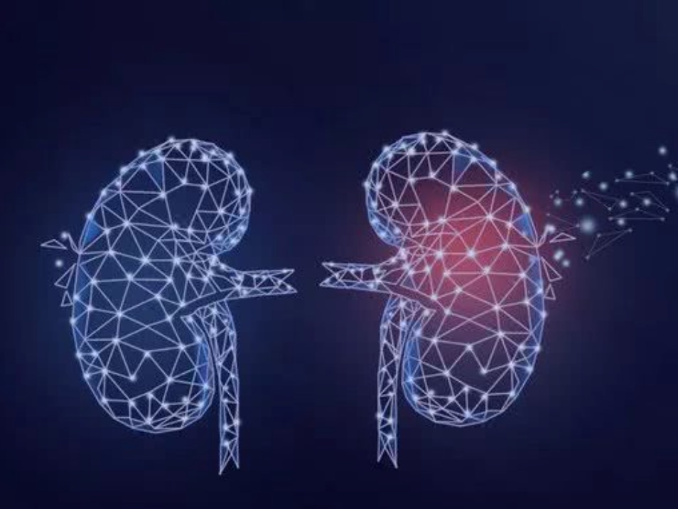 默沙东帕博利珠单抗辅助治疗 接受肾切除术后的肾细胞癌患者研究 首次公布