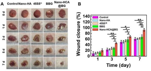 科研新成果：科研人员制备出生物玻璃可高效修复损伤皮肤