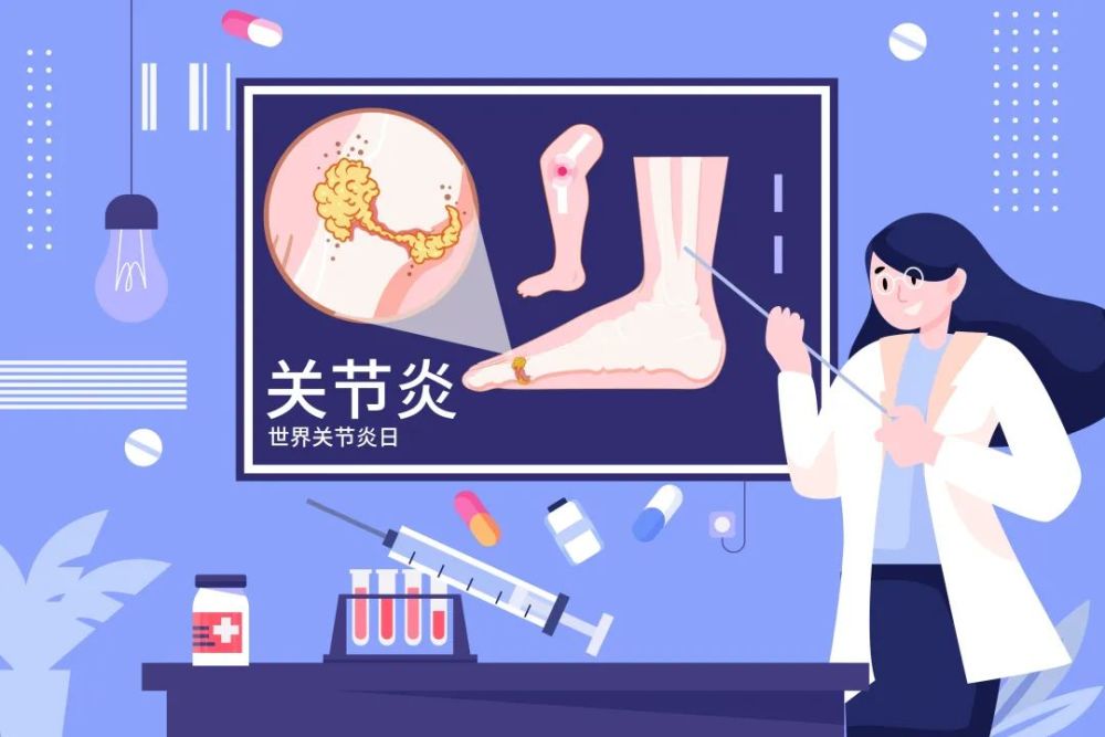 专家：膝骨关节炎更“青睐”女性 体重是重要诱因