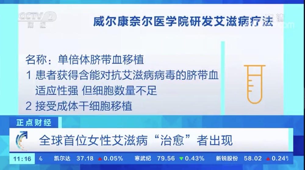 利用脐带血干细胞疗法 全球首位女性艾滋病“治愈”者出现