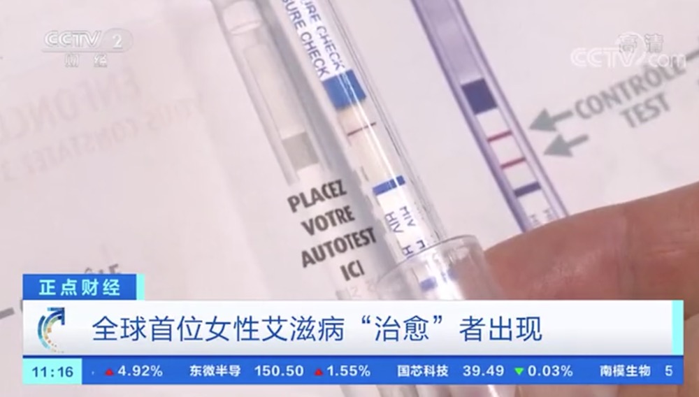 利用脐带血干细胞疗法 全球首位女性艾滋病“治愈”者出现-肽度TIMEDOO