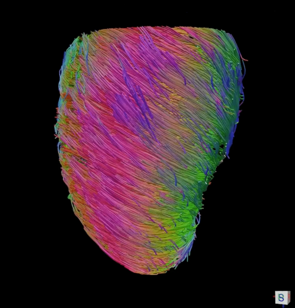 麻省总医院和麻省理工学院的研究人员合作创造第一颗生物机械混合心脏-肽度TIMEDOO