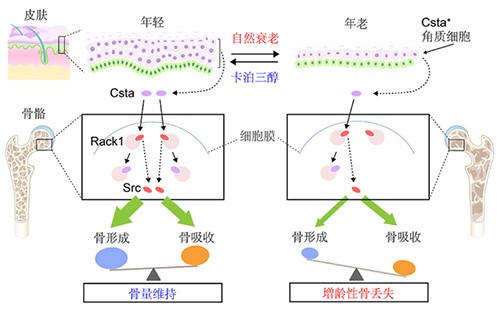 南方医科大学第三附属医院黄彬团队在骨质疏松症发生机制研究方面取得新进展