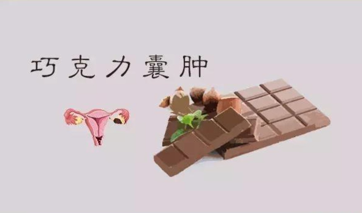 巧克力囊肿：名字很“甜蜜”，却会影响生育