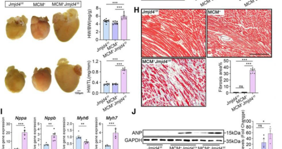 科学家发现扩张型心肌病分子病理机制