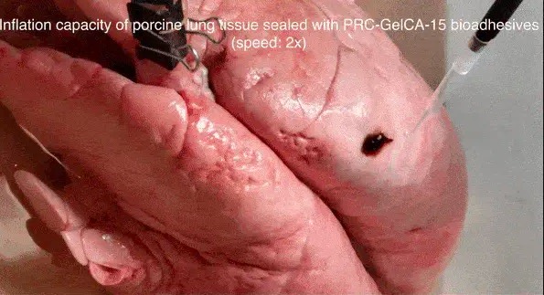 洛杉矶特拉萨基研究所研发出基于明胶的生物胶,快速在体内密封伤口-肽度TIMEDOO