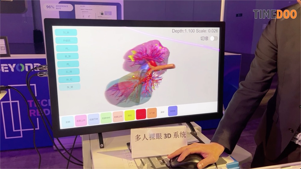创新裸眼3D技术,引领外科手术新时代-肽度TIMEDOO