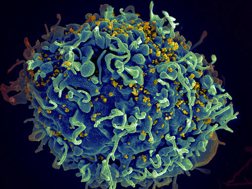 揭示HIV潜伏细胞的隐藏之地：脑部微胶质细胞成为持久病毒库