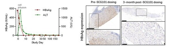 星汉德生物公布SCG101 TCR-T细胞治疗最新突破临床数据-肽度TIMEDOO