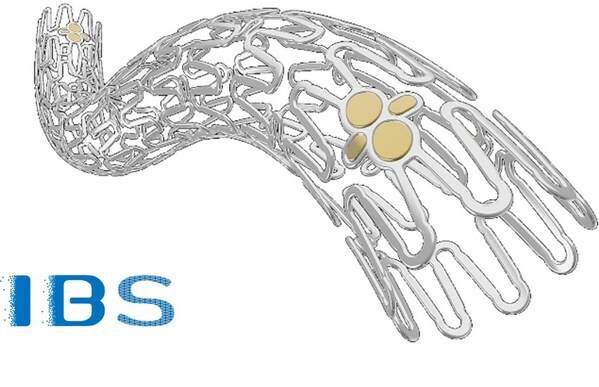 先健科技IBS®可吸收药物洗脱冠脉支架系统完成III期临床研究入组-肽度TIMEDOO