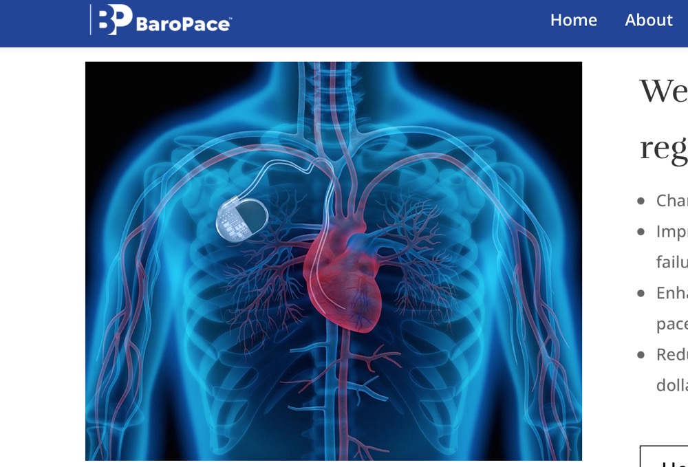 BaroPace, Inc. 宣布参加非药物高血压和心力衰竭治疗试验的首批患者