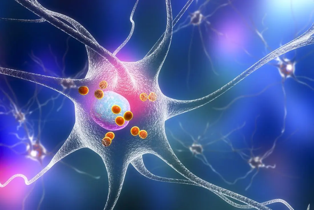 科学家发现检测帕金森样病的潜在新标志物