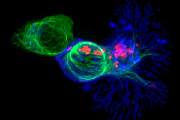 生物仿生纳米疫苗：改善癌症免疫疗法的新希望