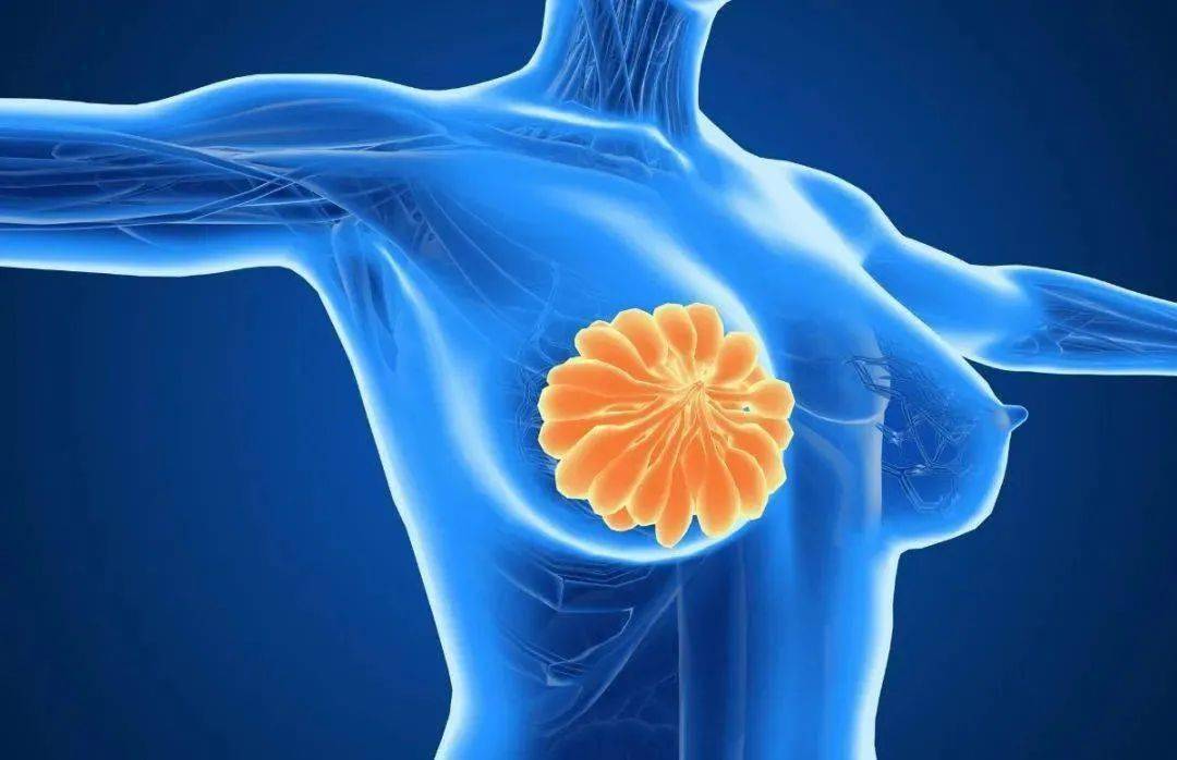 乳腺癌分子分型第一证，妈妈泰谱®（MammaTyper®）正式获NMPA批准