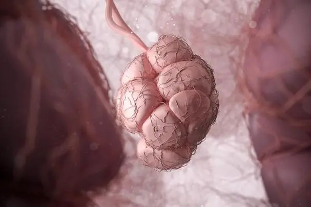 研究人员发现乳腺癌转移的“开关”