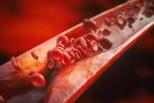 Sirius Therapeutics开始新一代长效因子XI siRNA抗凝剂治疗血栓栓塞性疾病的1期临床试验