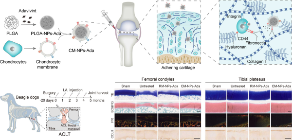 国家纳米中心等在骨关节炎治疗纳米药物库方面取得进展