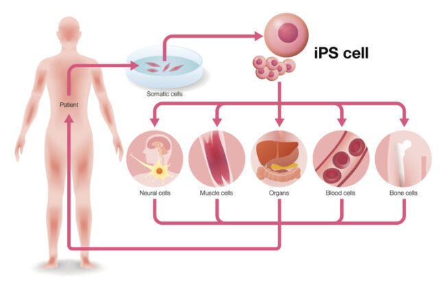 iPSCs:先进治疗的“起始物料”,为大规模疾病治疗带来希望-肽度TIMEDOO