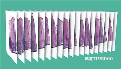 新平台可绘制亚细胞精度的组织3D图