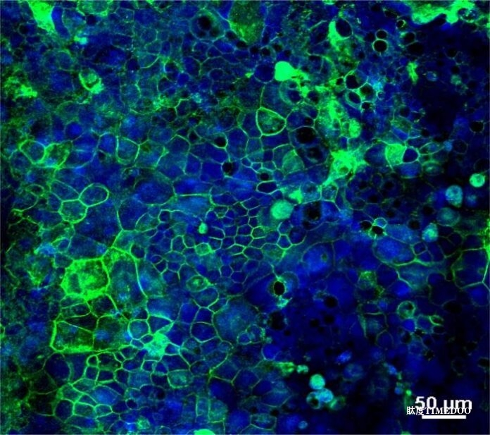 揭开谜团:麦克马斯特大学研究团队发现乳糜泻的致病机制新线索-肽度TIMEDOO
