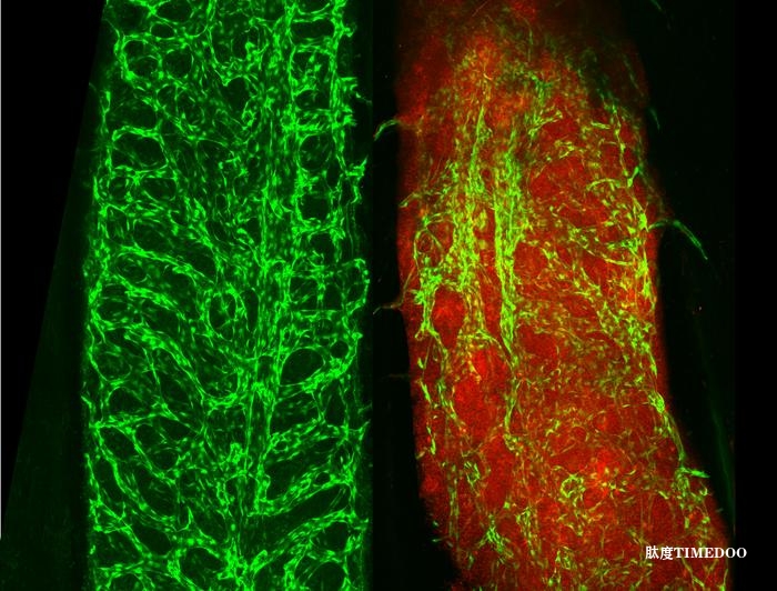细胞外囊泡中的“可视化”癌症生物标志物潜力