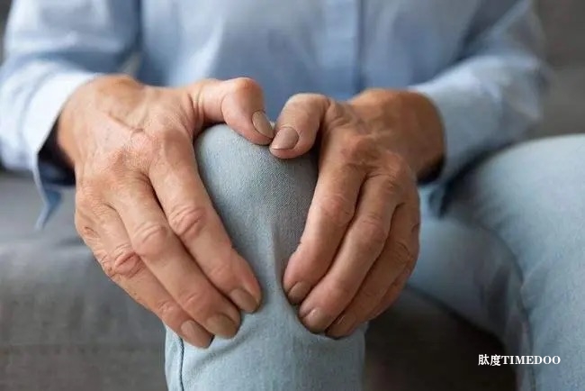 研究人员发现类风湿关节炎治疗新策略