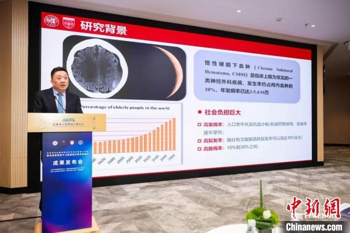 最新成果为非急性硬膜下血肿患者提供微创新疗法