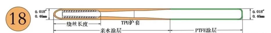 获批上市!国产血管介入微导丝-肽度TIMEDOO