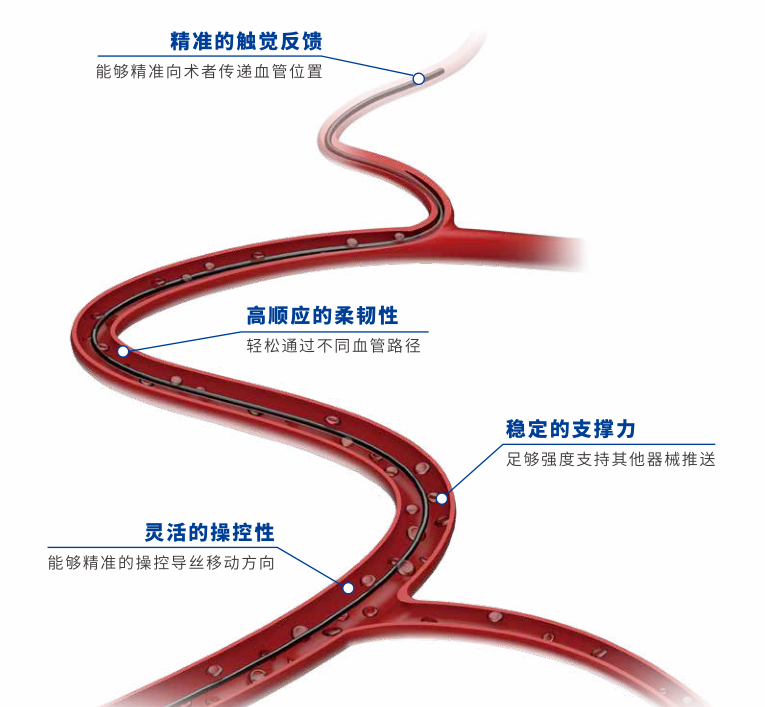 获批上市!国产血管介入微导丝-肽度TIMEDOO