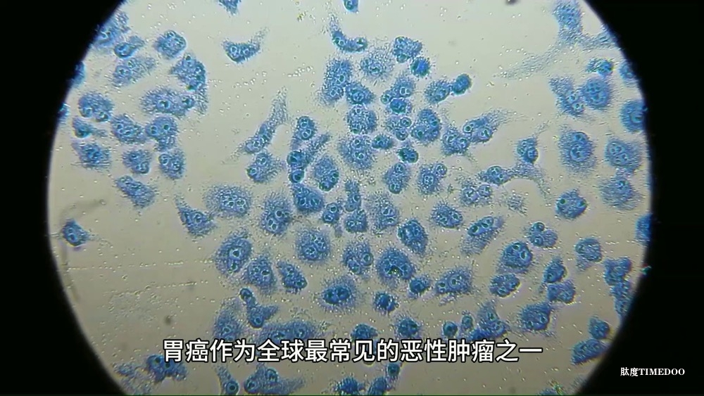 国国家药品监督管理局批准威络益（佐妥昔单抗）一线治疗晚期胃或胃食管交界处腺癌