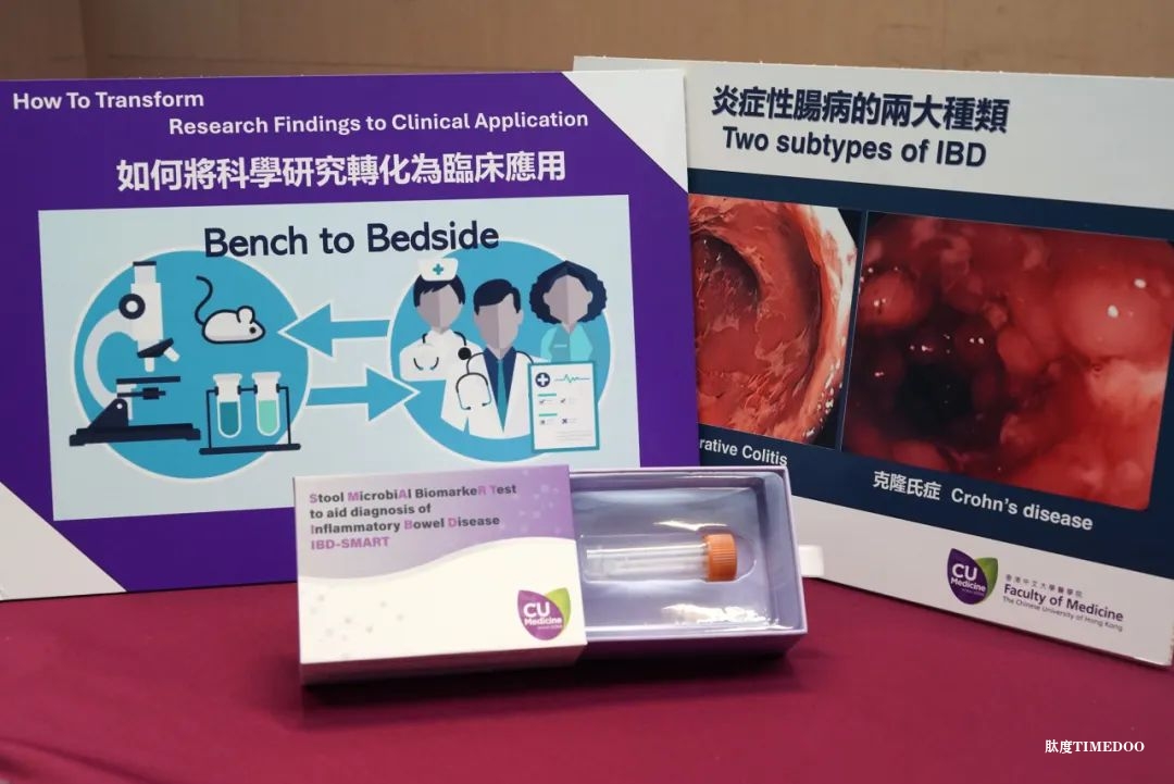 粪便也能诊断肠道疾病？他们的研究突破传统思路-肽度TIMEDOO