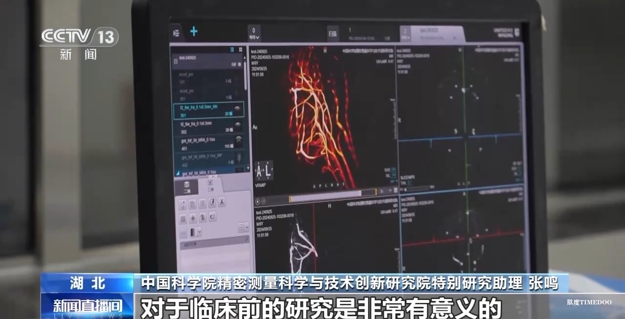 中国科学院团队成功突破“多核”磁共振成像技术-肽度TIMEDOO