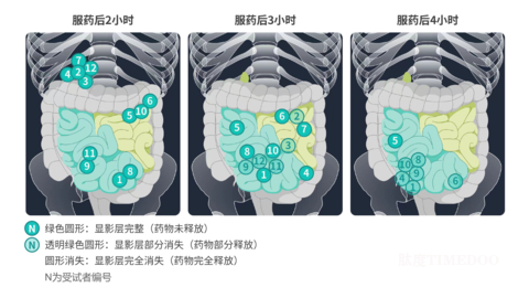 三迭纪IgA肾病药物产品D23取得积极临床结果，验证精准肠道靶向递送能力