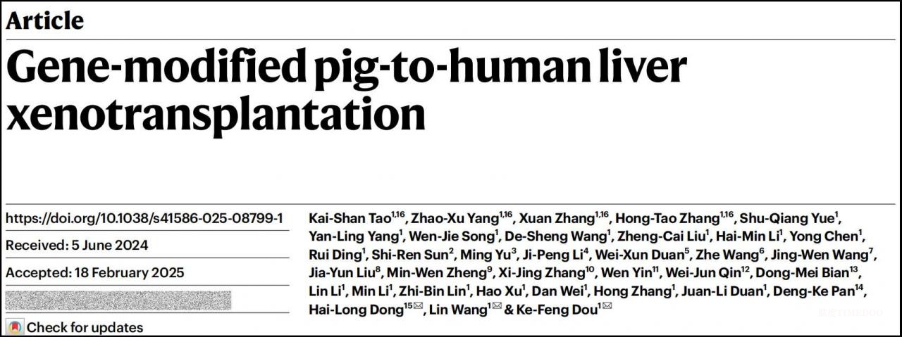 《自然》网站相关报道截图。受访者供图 全球首例!我国科学家实现基因编辑猪肝脏人体移植-肽度TIMEDOO