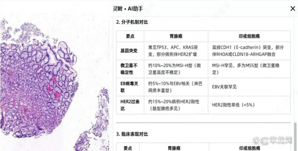 可识别9大器官57种肿瘤亚型 重庆发布“诊疗级”病理大模型-肽度TIMEDOO