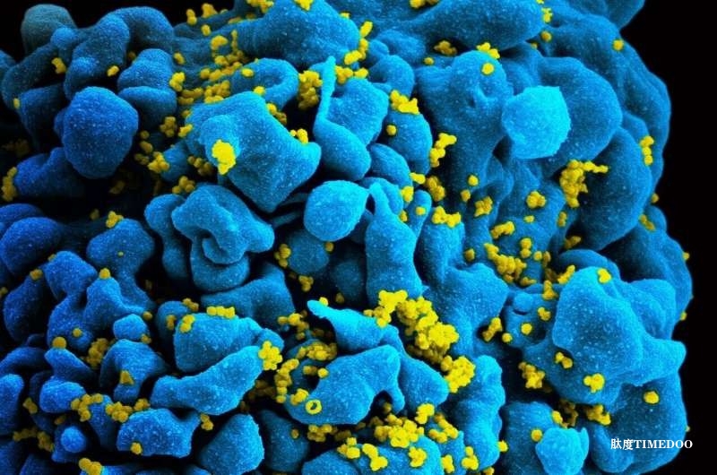 《柳叶刀·HIV》研究：国际援助削减或致数百万新增HIV感染与死亡