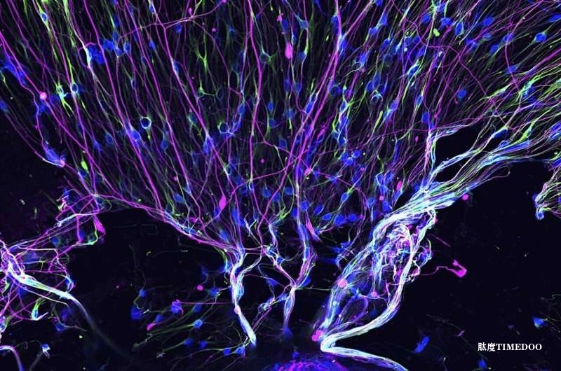 科学家揭示神经丝在神经退行性疾病中的作用机制，为新疗法提供思路