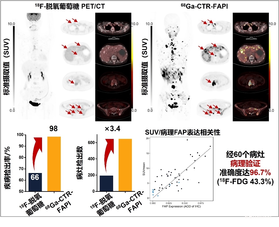 北京大学刘志博团队与合作者报道靶向共价核药物有望改变甲状腺髓样癌诊疗方案