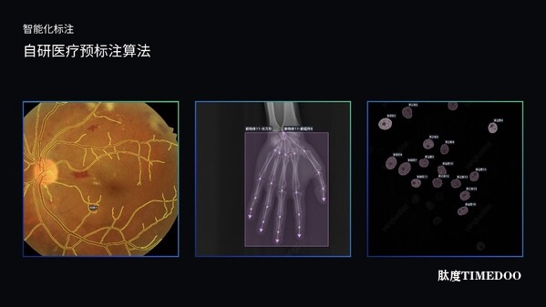 澳鹏发布MediGo医疗大模型数据开发平台 破解医疗AI数据瓶颈-肽度TIMEDOO