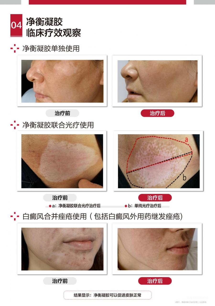 9.jpg 科学循证 净衡无忧——净衡凝胶新品上市会暨功效性护肤品学术研讨会圆满落幕-肽度TIMEDOO