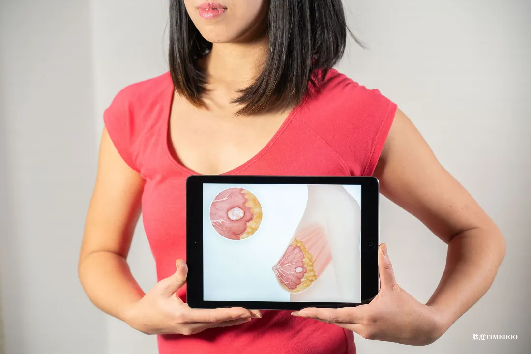 德研究:定期接受乳腺X线筛查可显著降低乳腺癌死亡率-肽度TIMEDOO
