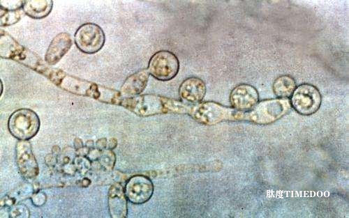 研究发现：白色念珠菌可在健康肠道中长期定植，三种真菌因子成关键